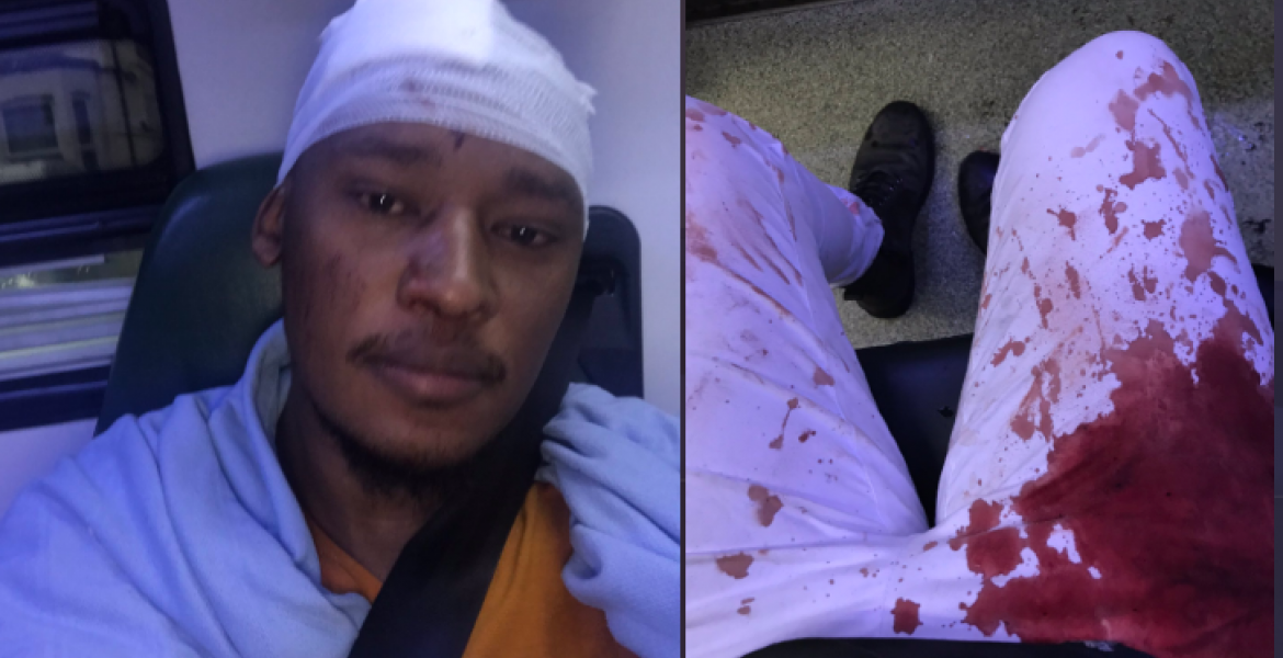 Kenyan Gay Man Attacked by Fellow Kenyans in London