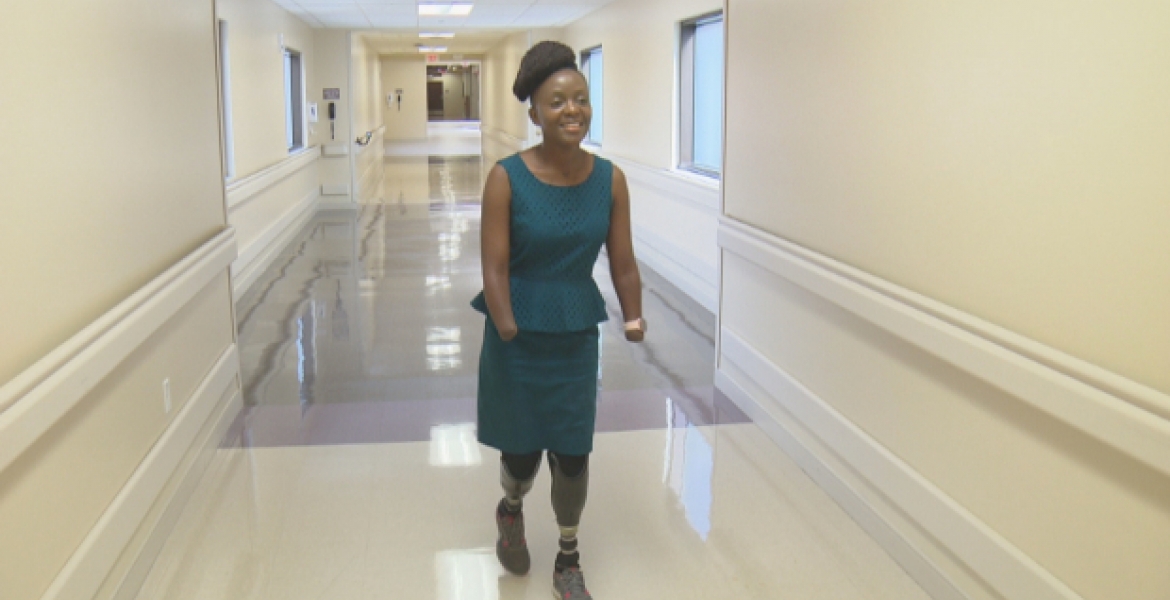 How Victoria Mugo, a Kenyan Woman in the US, Lost All Her Hands and Legs 