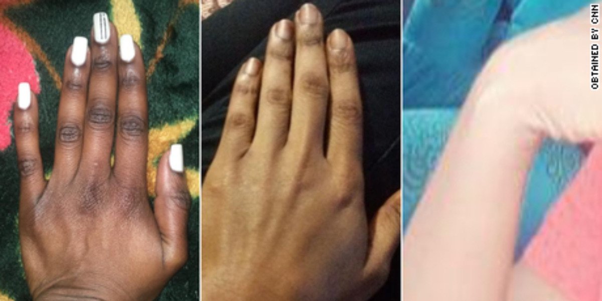 Kenya Battles Skin Bleaching Trend Despite Ban on 400 Dangerous Cosmetics