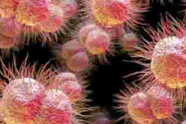 Man Contracts 'World Worst' Super-Gonorrhea 