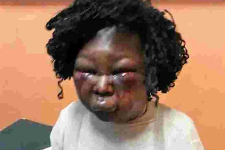 Kenyan Man Who Battered Expectant Wife Almost to Death Arrested