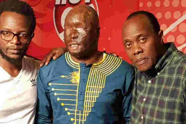 Kenyan Police Officer Narrates How His Wife Attacked Him with Surphuric Acid While Sleeping 
