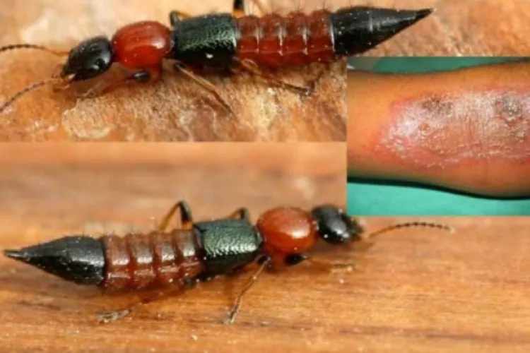 Kenyans Decry the Return of the Dreaded ‘Nairobi Fly’
