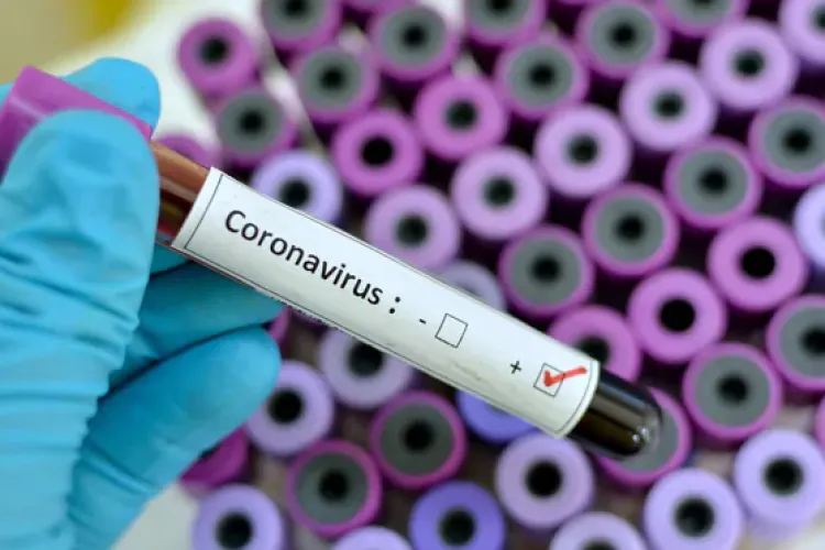 Nigeria Confirms Coronavirus Case, the First in Sub-Saharan Africa