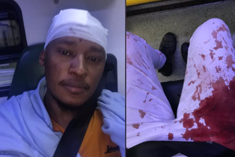 Kenyan Gay Man Attacked by Fellow Kenyans in London