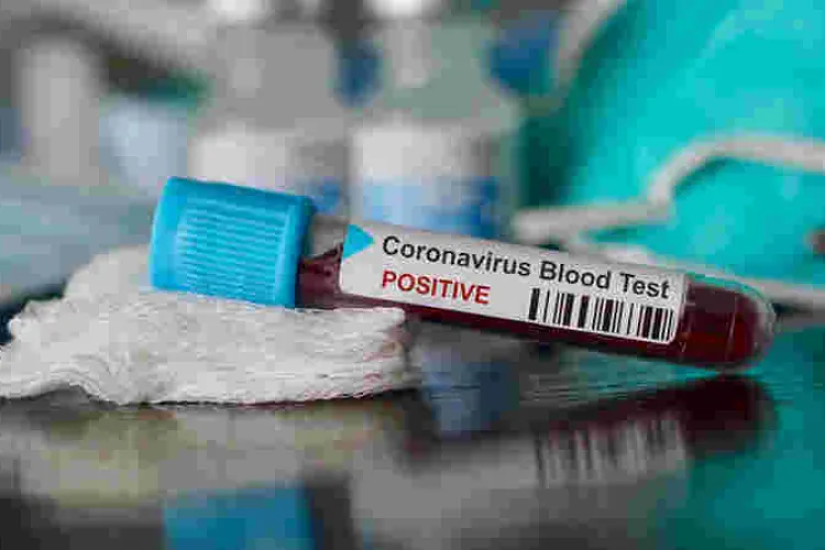 Ugandan Man, Daughter Arrested with Alleged Coronavirus ‘Vaccine’
