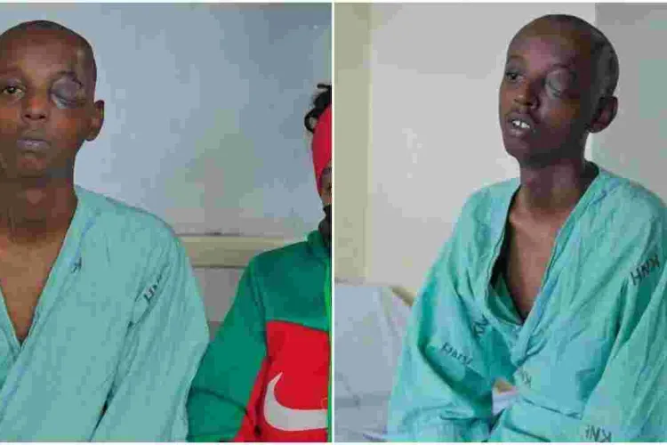 KNH Surgeons Save Teen with a Knife Lodged in the Eye 