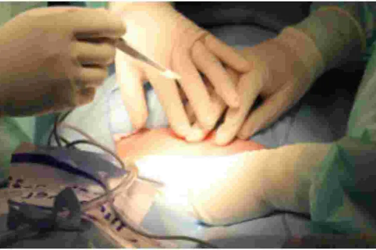 Catholic Priest Undergoes First Successful Heart Valve Transplant in Kenya