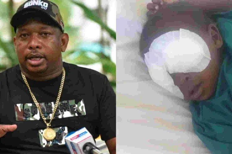 Sonko Offers to Fly Baby Sagini to South China for Eye Implants