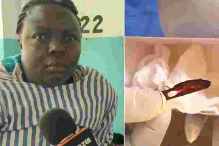 Doctors Remove a Scalpel Blade from Kenyan Woman’s Abdomen 11 Years After Surgery
