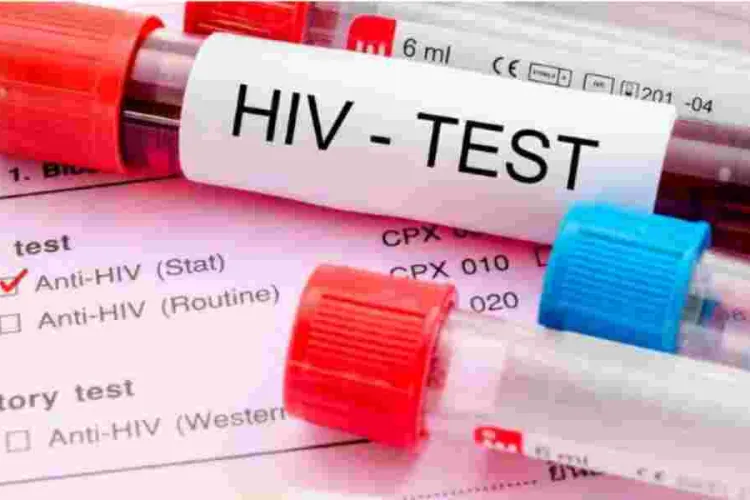 Concern as Nine Kenyan Counties Record Surge in HIV Cases