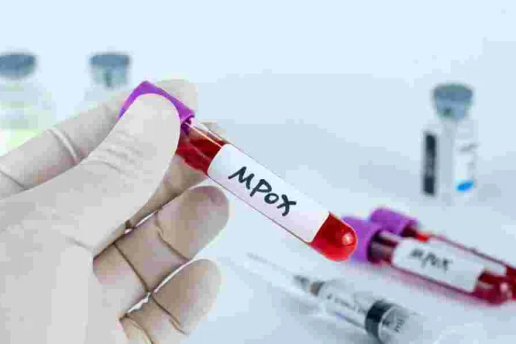 Kenya Intensifies Mpox Surveillance Amid Rising Cases