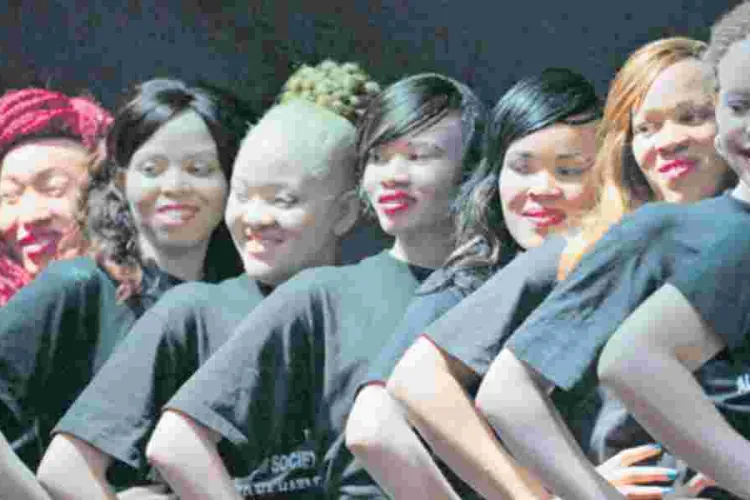 The Unspoken Hardships Facing Kenyan Women Living with Albinism