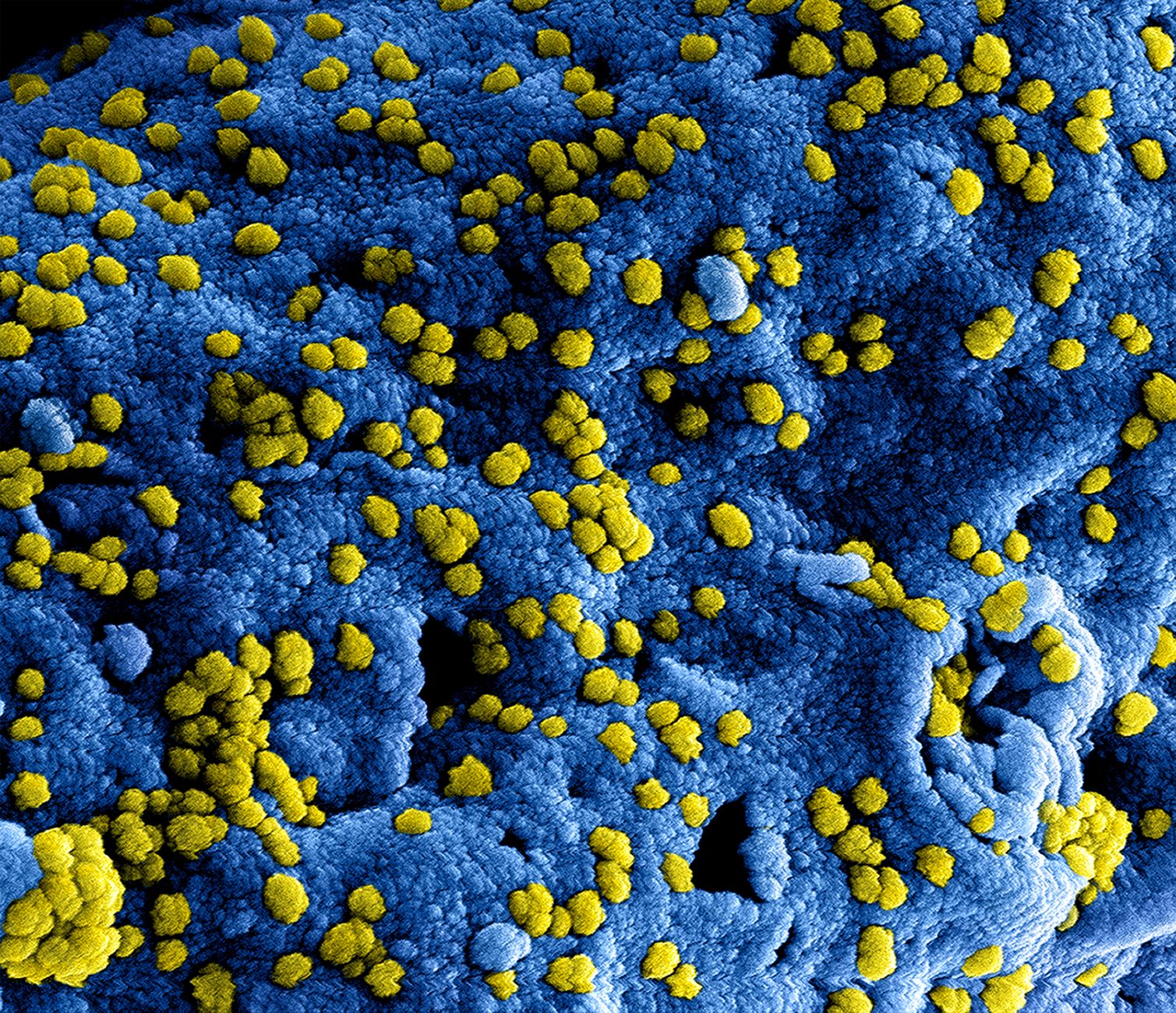 Africa CDC Reaffirms Support to Kenya Following Confirmation of Four Additional Ebola Cases