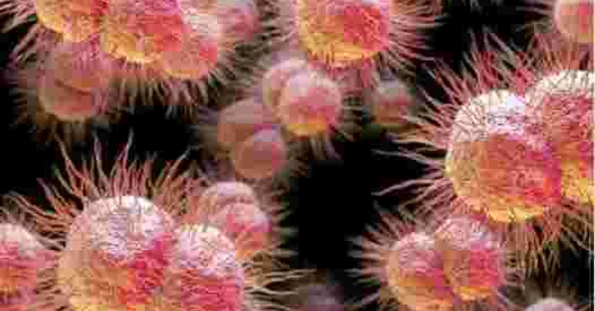 Man Contracts 'World Worst' Super-Gonorrhea