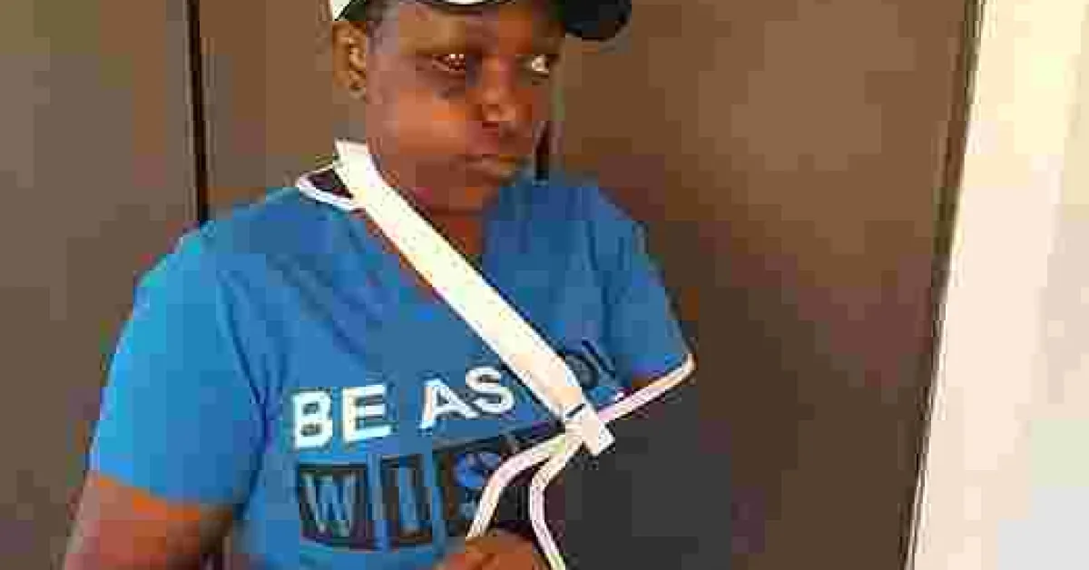 Female Nyeri MCA Sustains Serious Injuries after Male Colleague Hits Her with a Beer Bottle During Bench-Marking Tour in Tanzania