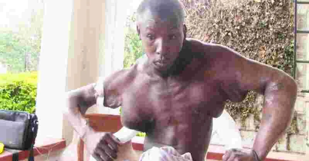 Kenyan Man with Abnormal Swelling in Chest, Arms Seeks Help to Get Live-Saving Surgery