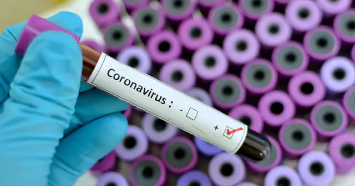 Nigeria Confirms Coronavirus Case, the First in Sub-Saharan Africa