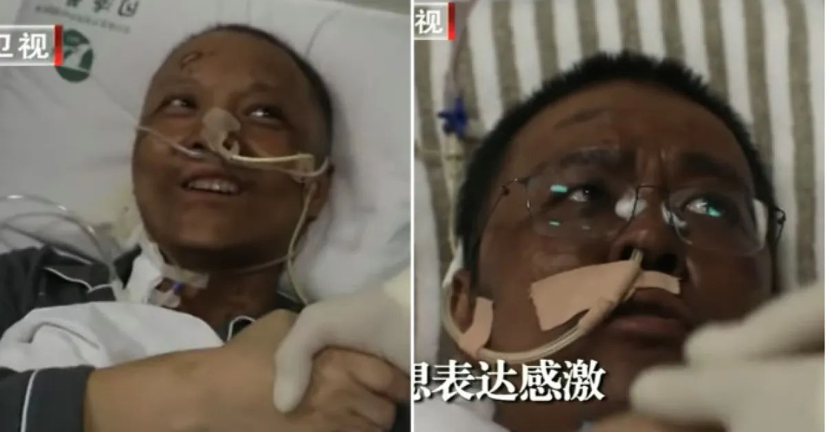 Chinese Doctors' Skin Color Turn Black after Recovering from Covid-19