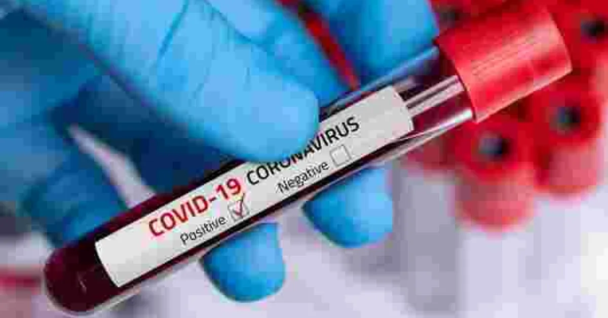 Kenya Records 12 New Covid-19 Cases