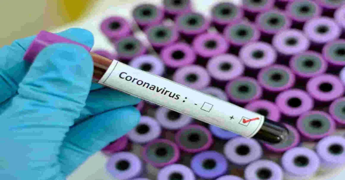 Kenya’s Coronavirus Cases Rise to 126