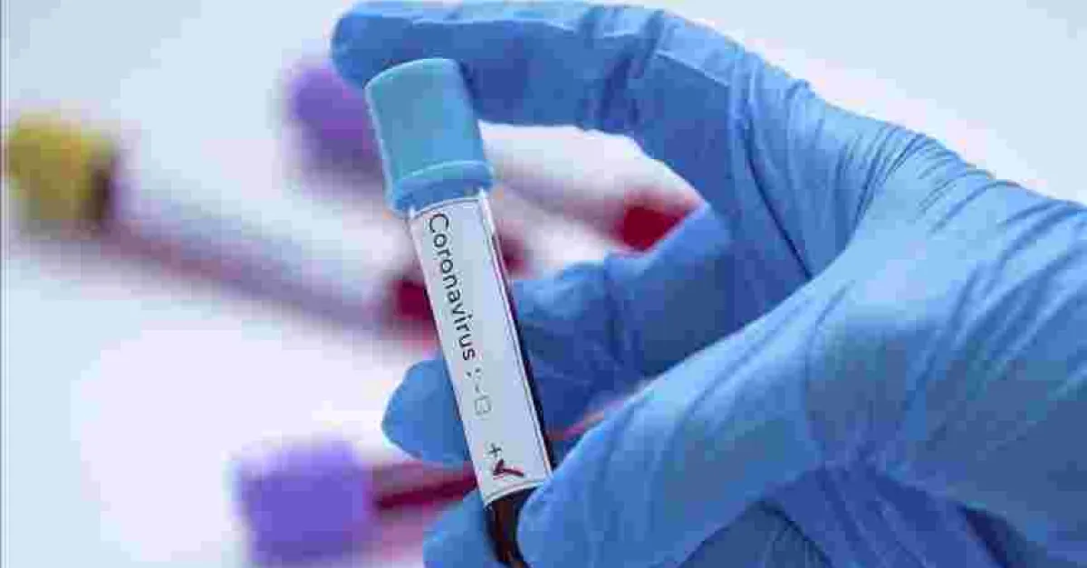 Kenyan Scientists to Conduct Trial for Three Possible Covid-19 Drugs