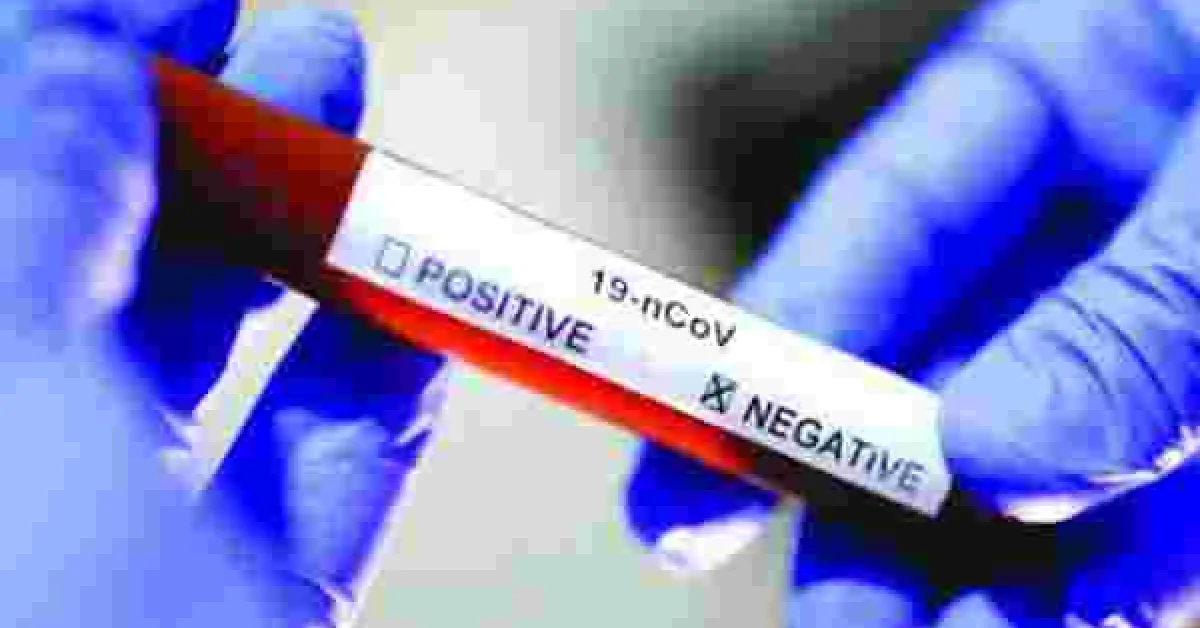 Kenya Records Highest Daily Covid-19 Recoveries as Cases Rise to 11,673