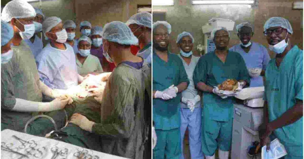 History as Kenyan Doctors Successfully Remove 13-Year-Old Stone Baby from Woman’s Abdomen
