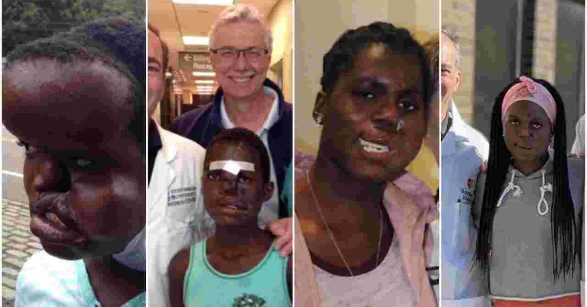 Kenyan Teen Returns Home After Life-Changing Surgeries in the US