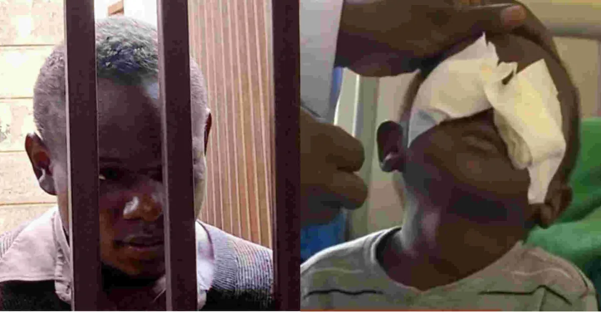 Main Suspect Arrested over Gouging Three-Year-old Boy’s Eyes in Kisii