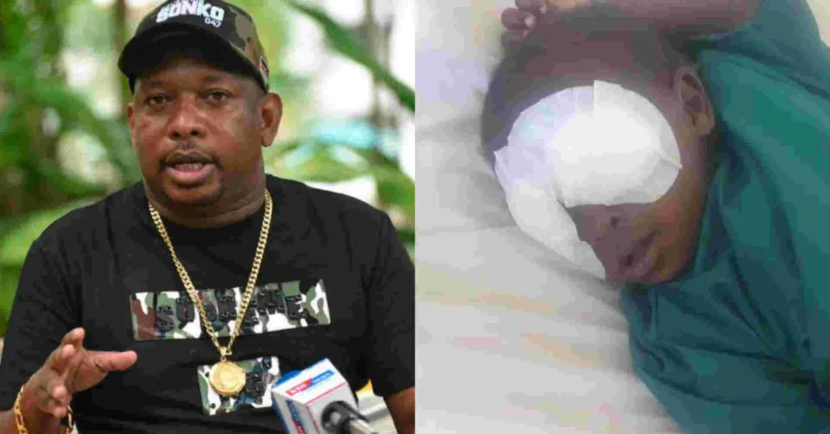 Sonko Offers to Fly Baby Sagini to South China for Eye Implants