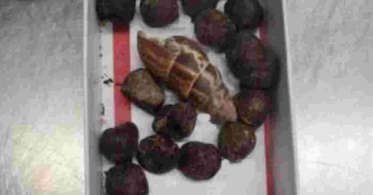 Woman Traveling from Kenya Arrested at Minnesota Airport With Giraffe Poop