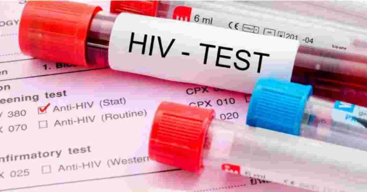 Concern as Nine Kenyan Counties Record Surge in HIV Cases