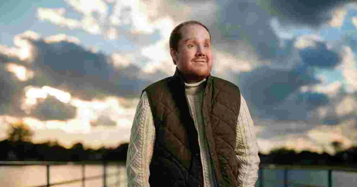 How 80 Surgeons Rebuilt a Human Face in 50 Hours After Suicide Attempt