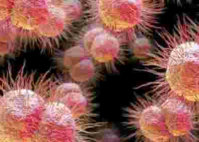Man Contracts 'World Worst' Super-Gonorrhea 