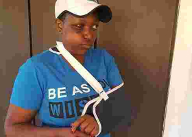 Female Nyeri MCA Sustains Serious Injuries after Male Colleague Hits Her with a Beer Bottle During Bench-Marking Tour in Tanzania