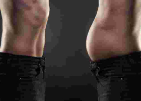 More Kenyan Men Seek Plastic Surgery 