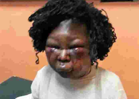 Kenyan Man Who Battered Expectant Wife Almost to Death Arrested