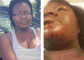 Kenyan Woman in Minnesota Nursing Serious Injuries after Attack by Husband at a Petrol Station