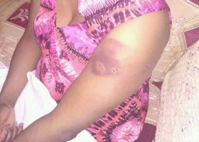 Githunguri MP Gabriel Kago Accused of Assaulting His Wife Using Hot Iron Box