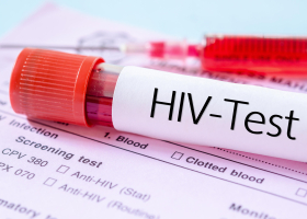 More Than 4,000 Homosexuals in Kilifi Infected with HIV, Official Says