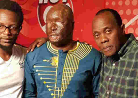 Kenyan Police Officer Narrates How His Wife Attacked Him with Surphuric Acid While Sleeping 