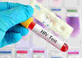 HIV-Positive London Man Cured of AIDS Virus after Bone Marrow Transplant