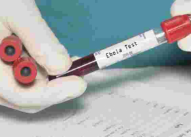 Kenyan Woman Quarantined After Showing Ebola-Like Symptoms Tests Negative for the Deadly Virus