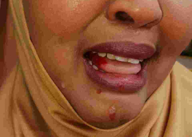 MP Rashid Kassim Attacks Wajir Woman Rep. Fatuma Gedi in Parliament