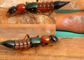 Kenyans Decry the Return of the Dreaded ‘Nairobi Fly’