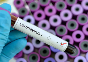 Kenyan Woman Who Arrived in Nairobi from the US Tests Positive for Coronavirus, Kenya’s First Case