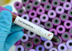 Rome-Based Kenyan Catholic Priest Tests Positive for Covid-19 After Leading Mass in Siaya