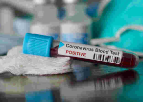 Ugandan Man, Daughter Arrested with Alleged Coronavirus ‘Vaccine’