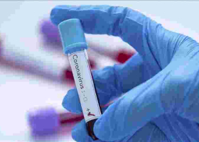 Kenyan Scientists to Conduct Trial for Three Possible Covid-19 Drugs 